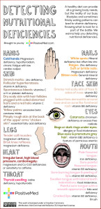 detecting-nutritional-deficienciesWEB